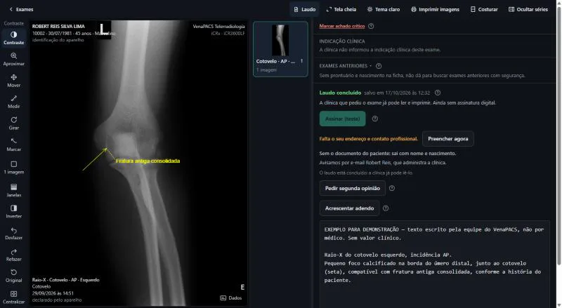 Laudo concluído, com o botão de assinar e o que falta para assinar