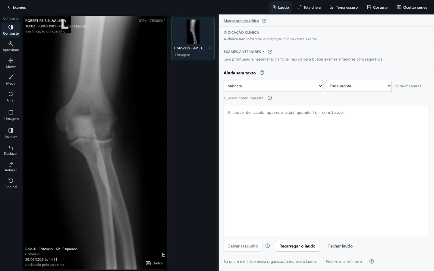 Visualizador com o painel do laudo aberto ao lado da radiografia: achado crítico, exames anteriores e máscaras. O campo do texto do laudo está vazio.